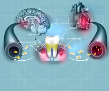 歯周病と全身の関係