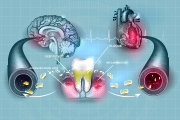 歯周病と全身の関係