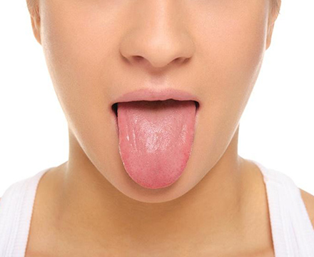 上部消化がん患者と健常者における舌苔と口腔内アセトアルデヒド濃度との関連