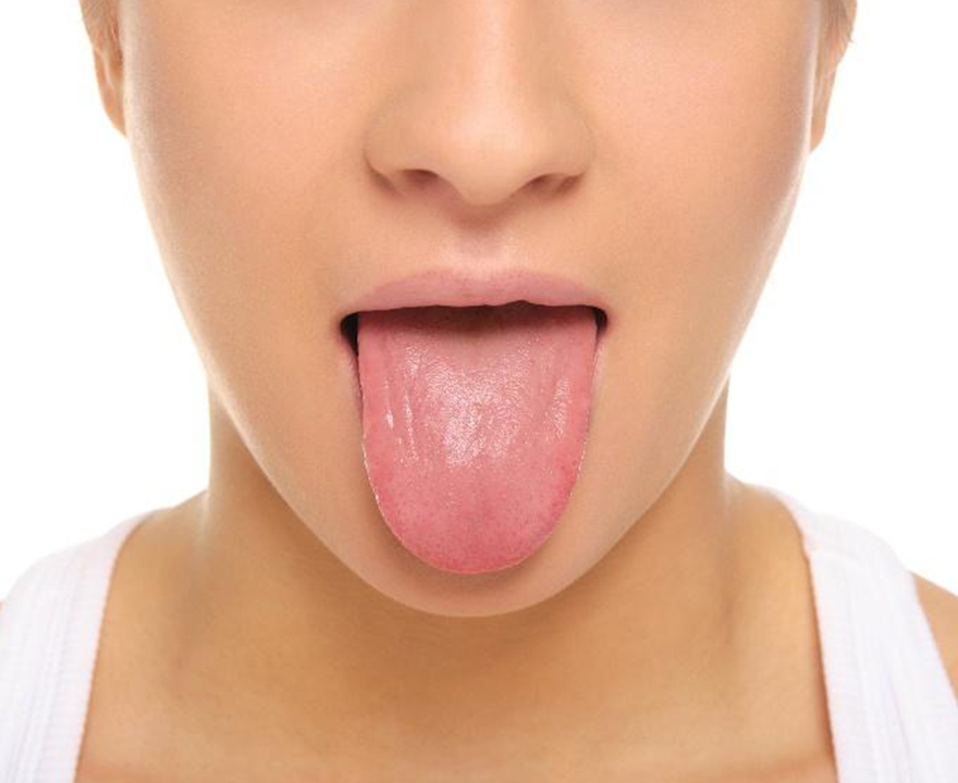 上部消化がん患者と健常者における舌苔と口腔内アセトアルデヒド濃度との関連